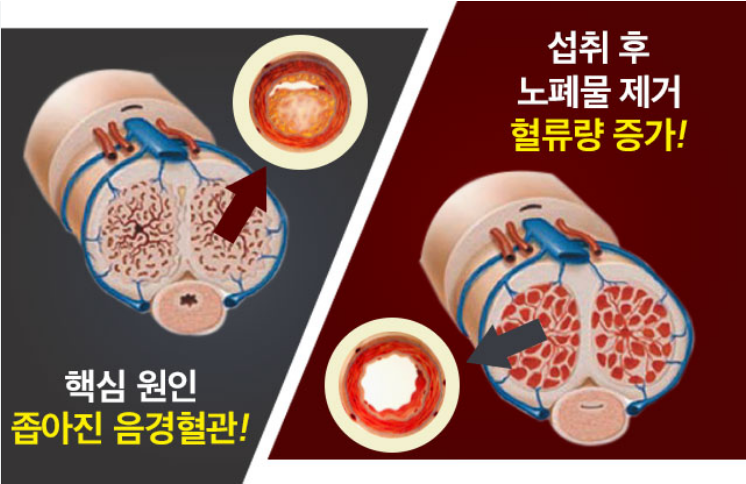 전립선 피에스맥스 효과 가격 복용법 대체제 비교